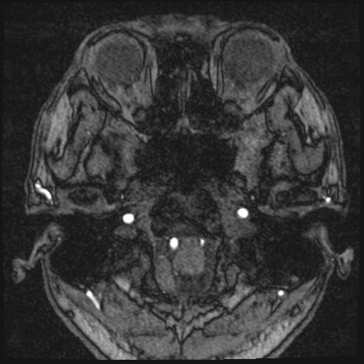 Click on the Serie image to view the images of VILLANUEVA, WILLIAM A.